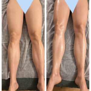 Ebook - Jambes de gazelles