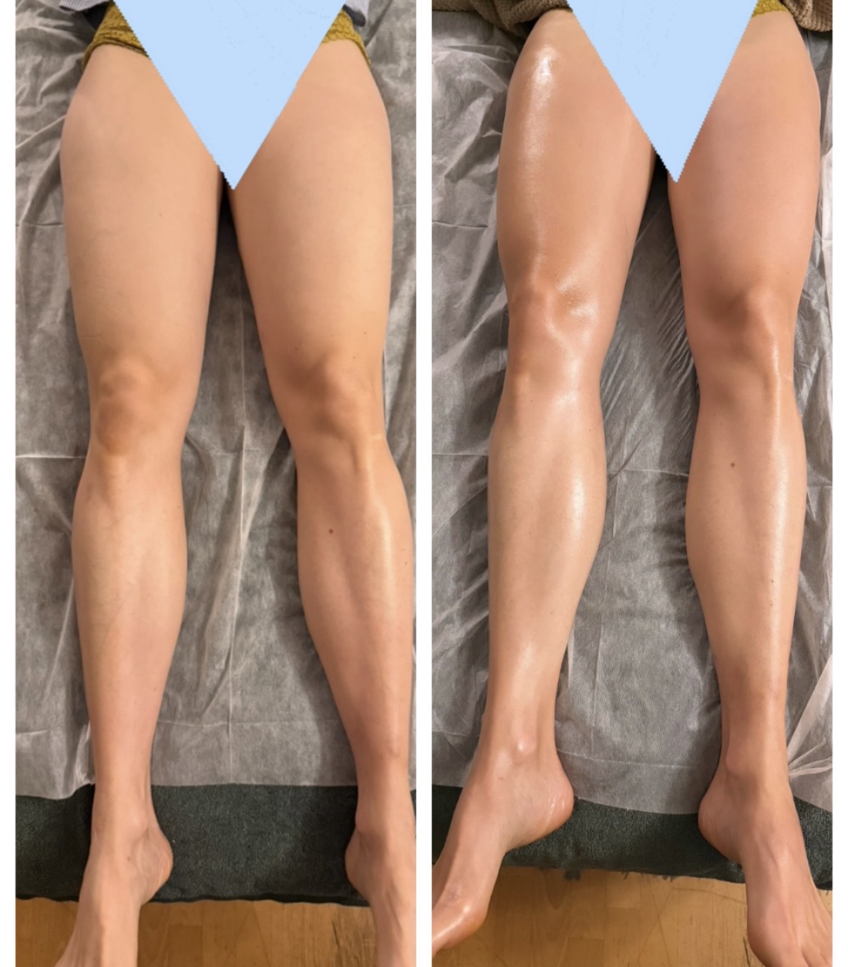 Ebook - Jambes de gazelles